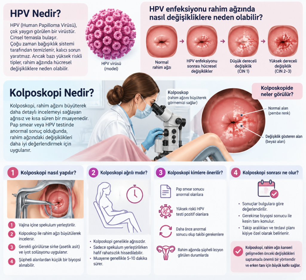 HPV ve kolposkopi nedir? Rahim ağzında HPV kaynaklı hücresel değişiklikler, kolposkopi muayenesi ve biyopsi işlemini gösteren bilgilendirici tıbbi şema.